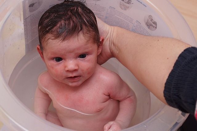 Mandi terlalu sering bisa memicu kulit bayi kering